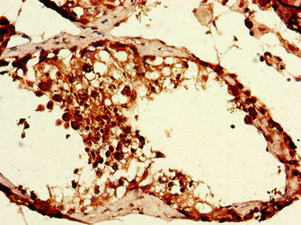 Immunohistochemistry (Formalin/PFA-fixed paraffin-embedded sections) - Anti-CAPZA1 antibody (AB234836)