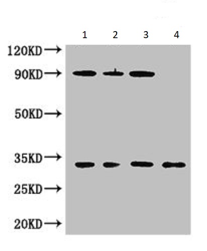 Western blot - Anti-CAPZA1 antibody (AB234836)