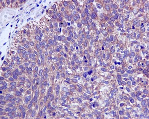 Immunohistochemistry (Formalin/PFA-fixed paraffin-embedded sections) - Anti-CAPZA1 antibody [EPR11210-4R] - BSA and Azide free (AB249883), expandable thumbnail