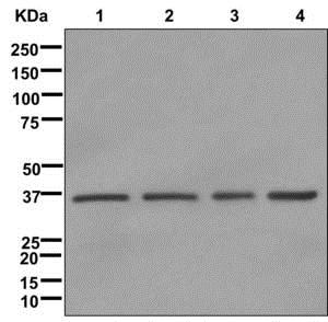 Western blot - Anti-CAPZA1 antibody [EPR11210-4R] - BSA and Azide free (AB249883), expandable thumbnail