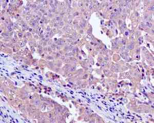 Immunohistochemistry (Formalin/PFA-fixed paraffin-embedded sections) - Anti-CAPZA1 antibody [EPR11210] - BSA and Azide free (AB249376)