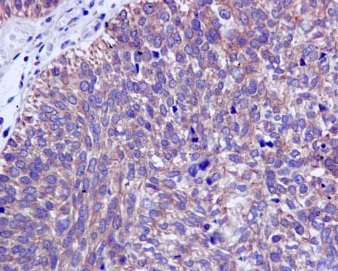 Immunohistochemistry (Formalin/PFA-fixed paraffin-embedded sections) - Anti-CAPZA1 antibody [EPR11210] - BSA and Azide free (AB249376)