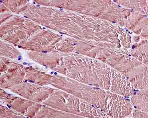 Immunohistochemistry (Formalin/PFA-fixed paraffin-embedded sections) - Anti-CAPZA1 antibody [EPR11210] - BSA and Azide free (AB249376)