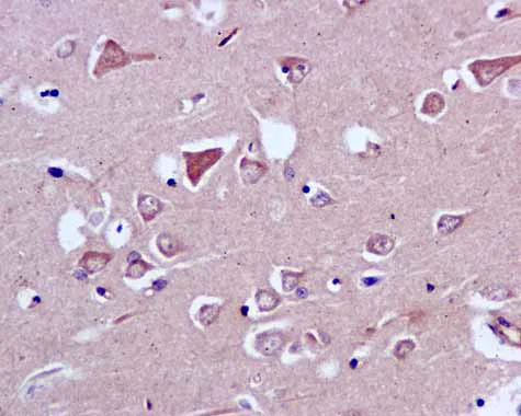 Immunohistochemistry (Formalin/PFA-fixed paraffin-embedded sections) - Anti-CAPZA1 antibody [EPR11210] - BSA and Azide free (AB249376)