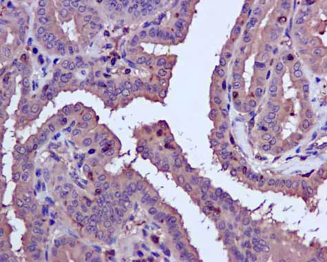 Immunohistochemistry (Formalin/PFA-fixed paraffin-embedded sections) - Anti-CAPZA1 antibody [EPR11210] - BSA and Azide free (AB249376)
