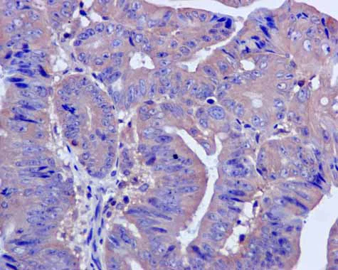 Immunohistochemistry (Formalin/PFA-fixed paraffin-embedded sections) - Anti-CAPZA1 antibody [EPR11210] - BSA and Azide free (AB249376)