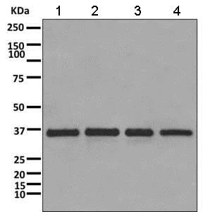 Western blot - Anti-CAPZA1 antibody [EPR11210] - BSA and Azide free (AB249376)
