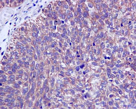 Immunohistochemistry (Formalin/PFA-fixed paraffin-embedded sections) - Anti-CAPZA1 + CAPZA2 antibody [EPR11210] (AB166892)