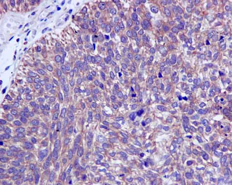 Immunohistochemistry (Formalin/PFA-fixed paraffin-embedded sections) - Anti-CAPZA1 + CAPZA2 antibody [EPR11210] - BSA and Azide free (AB249376)