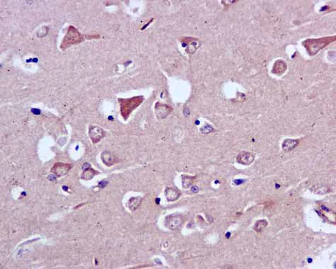 Immunohistochemistry (Formalin/PFA-fixed paraffin-embedded sections) - Anti-CAPZA1 + CAPZA2 antibody [EPR11210] - BSA and Azide free (AB249376)