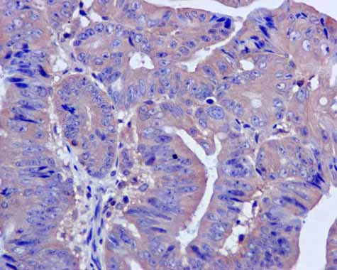 Immunohistochemistry (Formalin/PFA-fixed paraffin-embedded sections) - Anti-CAPZA1 + CAPZA2 antibody [EPR11210] - BSA and Azide free (AB249376)