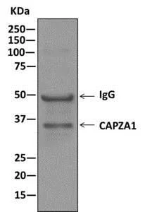 Immunoprecipitation - Anti-CAPZA1 + CAPZA2 antibody [EPR11210] - BSA and Azide free (AB249376)