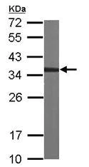Western blot - Anti-CAPZA2 antibody (AB101451)