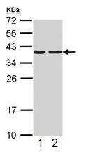 Western blot - Anti-CAPZA2 antibody (AB101451)