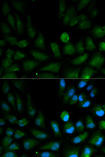 Immunocytochemistry/ Immunofluorescence - Anti-CAPZA2 antibody (AB175378)