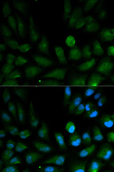 Immunocytochemistry/ Immunofluorescence - Anti-CAPZA2 antibody (AB175378)