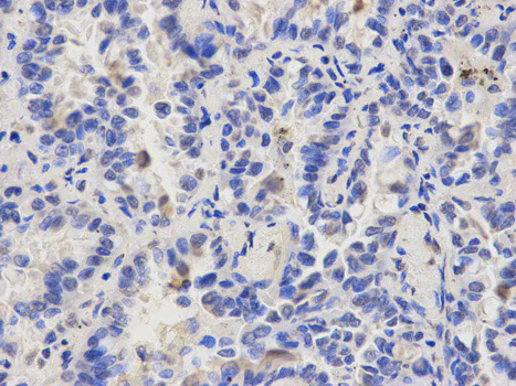 Immunohistochemistry (Formalin/PFA-fixed paraffin-embedded sections) - Anti-CAPZA2 antibody (AB175378)