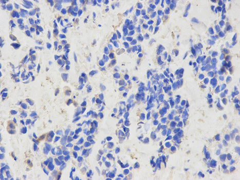 Immunohistochemistry (Formalin/PFA-fixed paraffin-embedded sections) - Anti-CAPZA2 antibody (AB175378)