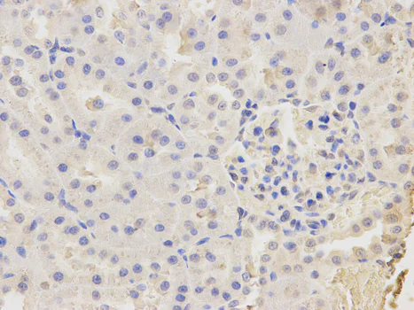 Immunohistochemistry (Formalin/PFA-fixed paraffin-embedded sections) - Anti-CAPZA2 antibody (AB175378)