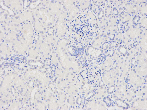 Immunohistochemistry (Formalin/PFA-fixed paraffin-embedded sections) - Anti-CAPZA2 antibody (AB175378)