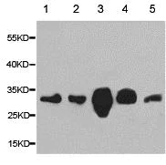 Western blot - Anti-CAPZA2 antibody (AB175378)