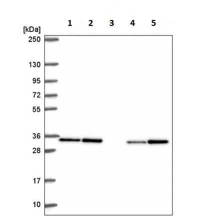Western blot - Anti-CAPZB antibody (AB220669)