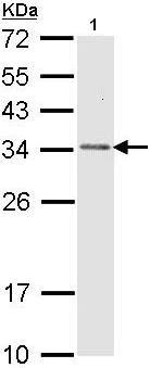 Western blot - Anti-CAPZB antibody (AB96618)