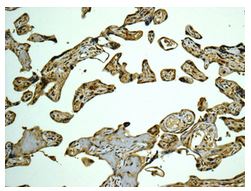 Immunohistochemistry (Formalin/PFA-fixed paraffin-embedded sections) - Anti-CAPZB antibody [EPR10236] (AB175212), expandable thumbnail