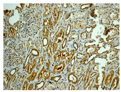 Immunohistochemistry (Formalin/PFA-fixed paraffin-embedded sections) - Anti-CAPZB antibody [EPR10236] (AB175212), expandable thumbnail