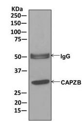 Immunoprecipitation - Anti-CAPZB antibody [EPR10236] (AB175212), expandable thumbnail