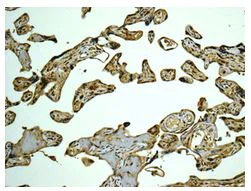 Immunohistochemistry (Formalin/PFA-fixed paraffin-embedded sections) - Anti-CAPZB antibody [EPR10236] - BSA and Azide free (AB249865)