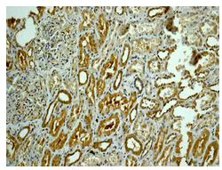 Immunohistochemistry (Formalin/PFA-fixed paraffin-embedded sections) - Anti-CAPZB antibody [EPR10236] - BSA and Azide free (AB249865)