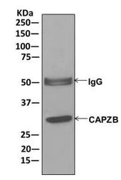 Immunoprecipitation - Anti-CAPZB antibody [EPR10236] - BSA and Azide free (AB249865)