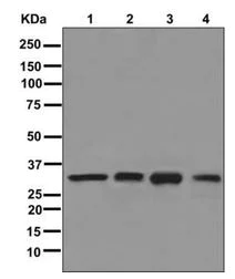Western blot - Anti-CAPZB antibody [EPR10236] - BSA and Azide free (AB249865)