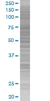 SDS-PAGE - CAPZB overexpression 293T lysate (whole cell) (AB94201)