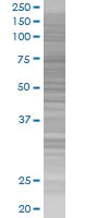 SDS-PAGE - CAPZB overexpression 293T lysate (whole cell) (AB94201)