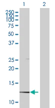 Western blot - CAPZB overexpression 293T lysate (whole cell) (AB94201)