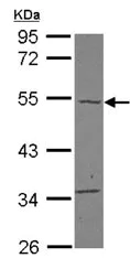 Western blot - Anti-carabin antibody (AB127694)