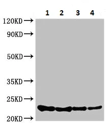 Western blot - Anti-Carbon storage regulator antibody (AB225947)