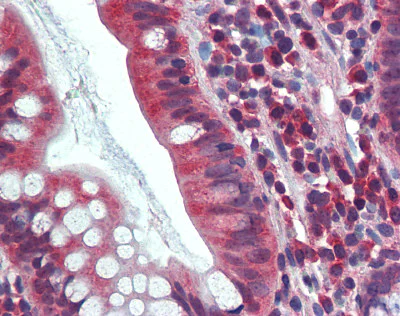 Immunohistochemistry (Formalin/PFA-fixed paraffin-embedded sections) - Anti-Carbonic Anhydrase 1/CA1 antibody (AB109755)