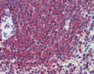 Immunohistochemistry (Formalin/PFA-fixed paraffin-embedded sections) - Anti-Carbonic Anhydrase 1/CA1 antibody (AB109755)