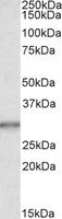 Western blot - Anti-Carbonic Anhydrase 1/CA1 antibody (AB109755)