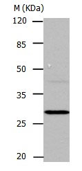 Western blot - Anti-Carbonic Anhydrase 1/CA1 antibody (AB182609)