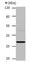 Western blot - Anti-Carbonic Anhydrase 1/CA1 antibody (AB182609)