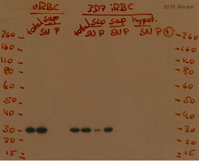 Western blot - Anti-Carbonic Anhydrase 1/CA1 antibody (AB182609)