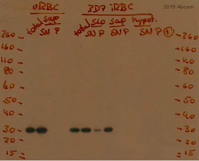 Western blot - Anti-Carbonic Anhydrase 1/CA1 antibody (AB182609)