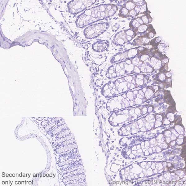 Immunohistochemistry (Formalin/PFA-fixed paraffin-embedded sections) - Anti-Carbonic Anhydrase 1/CA1 antibody [EPR23232-286] (AB267475)