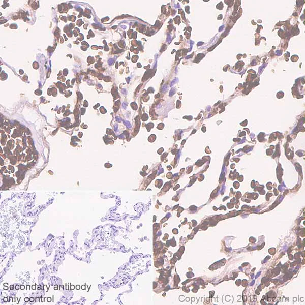 Immunohistochemistry (Formalin/PFA-fixed paraffin-embedded sections) - Anti-Carbonic Anhydrase 1/CA1 antibody [EPR23232-286] (AB267475)