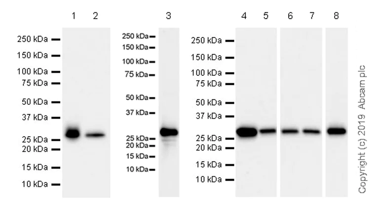 Western blot - Anti-Carbonic Anhydrase 1/CA1 antibody [EPR23232-286] (AB267475)
