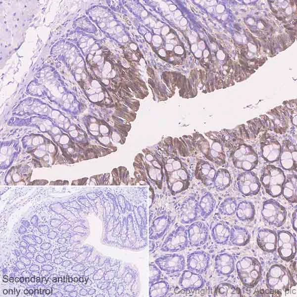 Immunohistochemistry (Formalin/PFA-fixed paraffin-embedded sections) - Anti-Carbonic Anhydrase 1/CA1 antibody [EPR23232-286] - BSA and Azide free (AB269951)